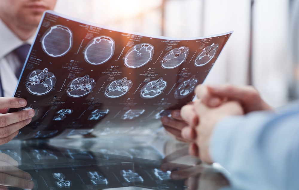 Brain Injury Lawyer